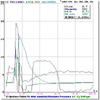 Acceleration1